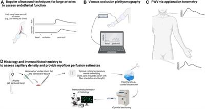 Making the case for resistance training in improving vascular function and skeletal muscle capillarization